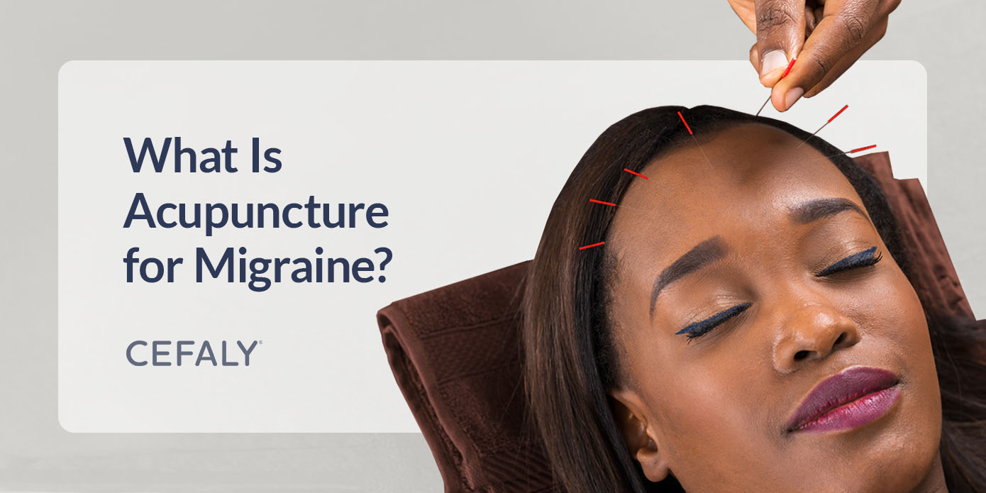 acupunture for migraine