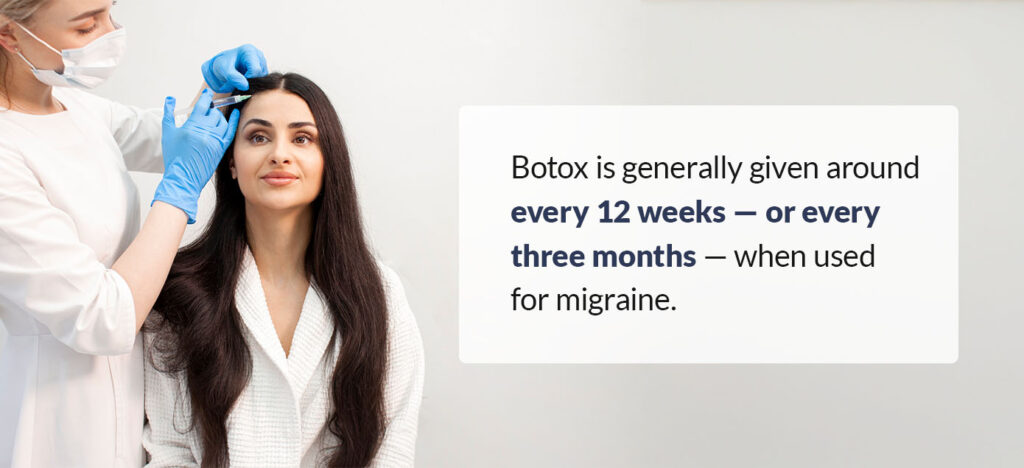 Botox for migraine is generally given around every 12 weeks